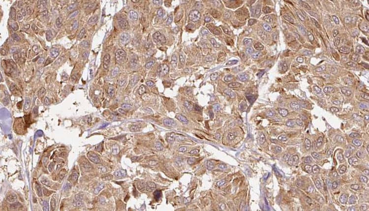 MMP13 Antibody