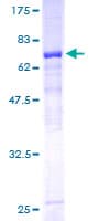 Human HKDC1 Protein (Recombinant GST)