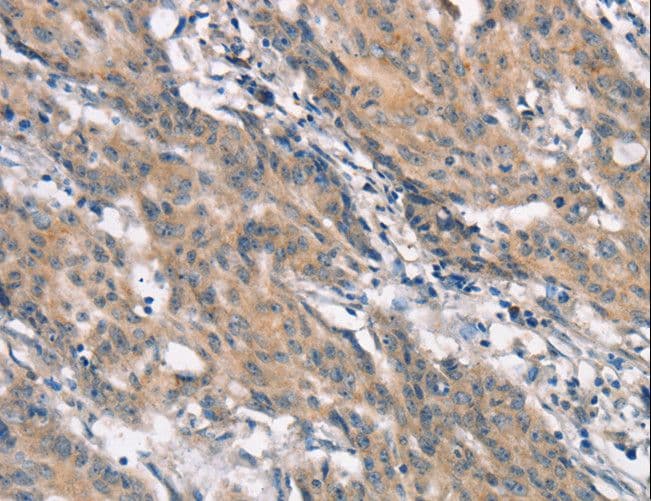CRKL Antibody