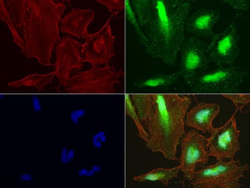 LGALS3 / Galectin 3 Antibody (clone UMAB189, Carrier-free)
