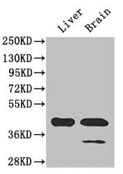 Polyclonal Rabbit anti-Human GLUL / Glutamine Synthetase Antibody (IHC, IF, WB)