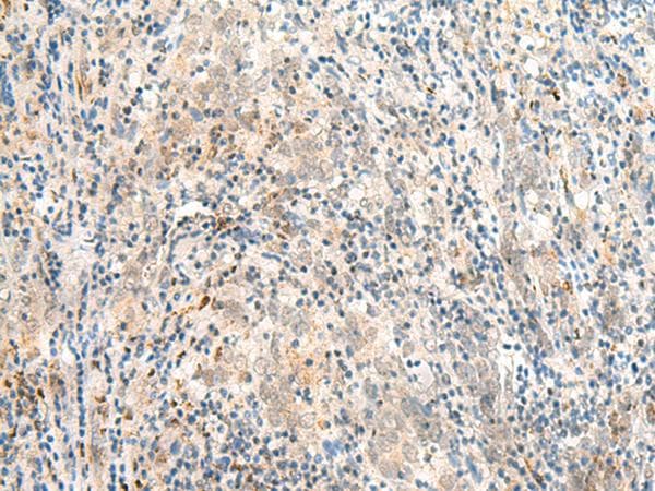 HN1 / ARM2 Antibody