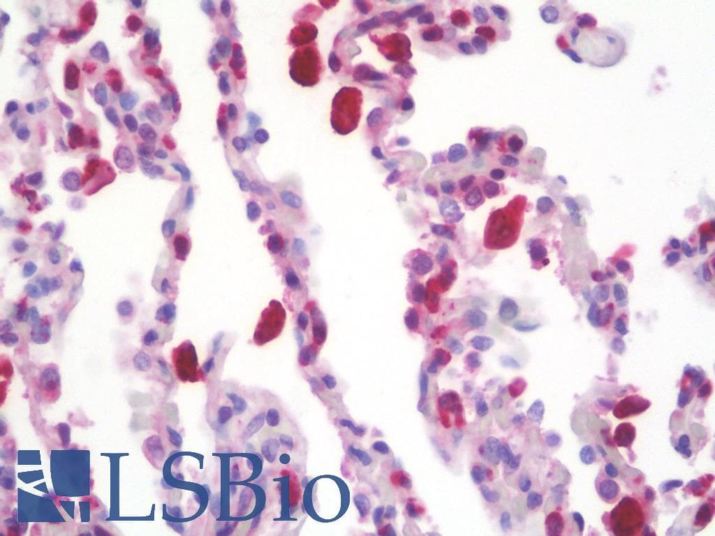 IHC-plus™ Monoclonal Mouse anti-Human CD68 Antibody (clone KP1, IHC, IF, WB)