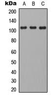 Polyclonal Rabbit anti-Human CD101 Antibody (Internal, WB)