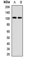 Polyclonal Rabbit anti-Human ZC3H14 Antibody (WB)