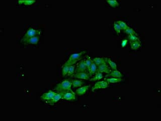 SIP / TP53INP1 Antibody