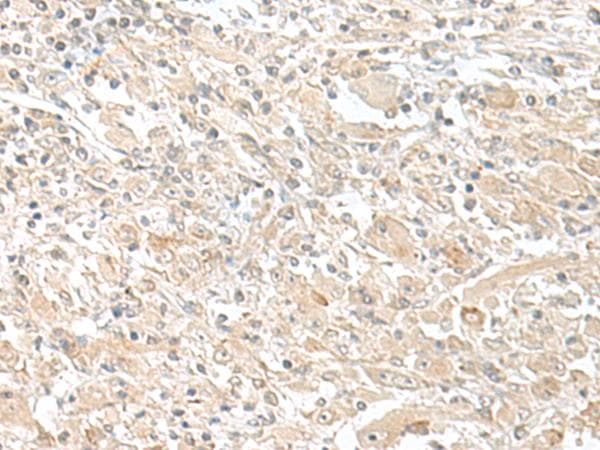 SMS / Spermine Synthase Antibody