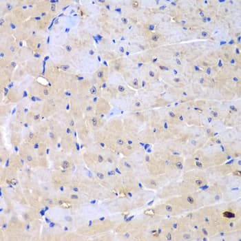 ARHGEF9 / Collybistin Antibody