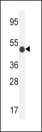GCNT2 Antibody (aa364-391)