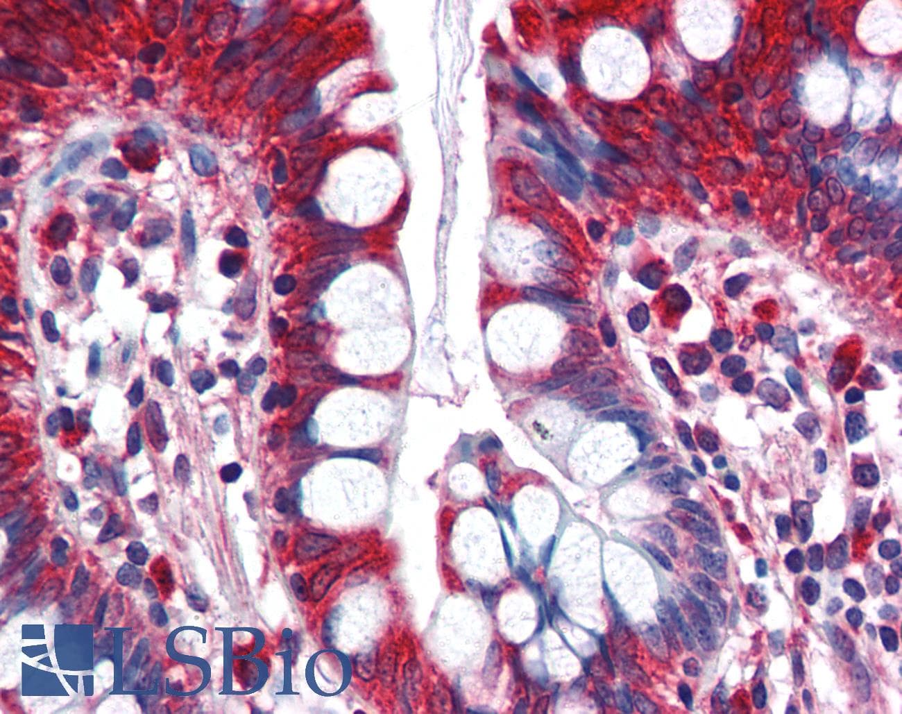 IHC-plus™ ACS5 / ACSL5 Antibody (aa727-739)