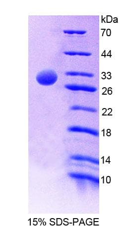 Human PTPN5 / STEP Protein (Recombinant His-T7, N-terminus)