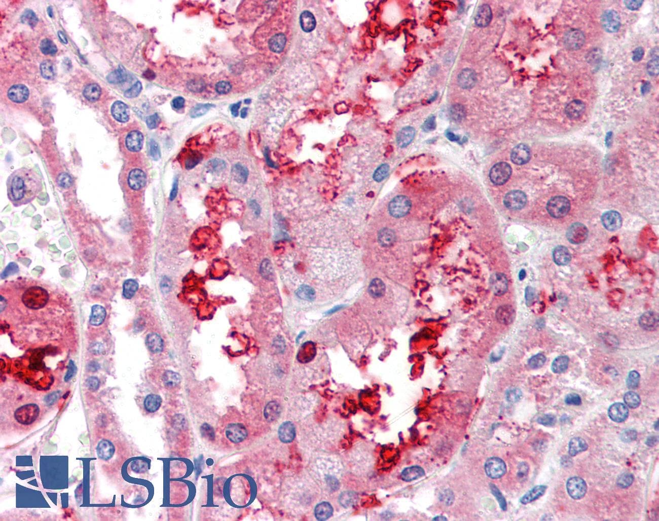 IHC-plus™ GCNT3 Antibody (N-Terminus)
