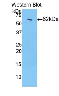 HSD17B12 Antibody (aa1-312, FITC)