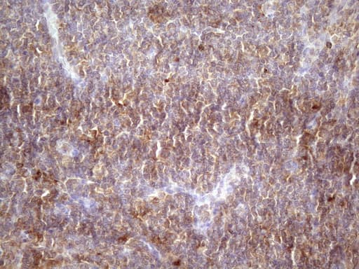 Monoclonal Mouse anti-Human HAVCR2 / TIM-3 Antibody (clone OTI2E2, aa22-202, IHC)