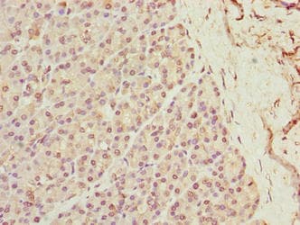 XPR1 Antibody (aa529-696)