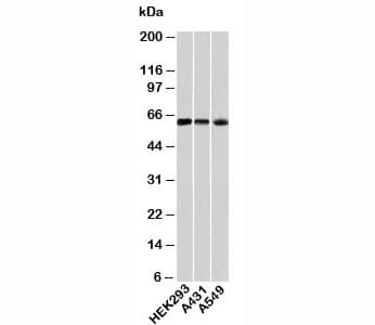 HSPD1 / HSP60 Antibody