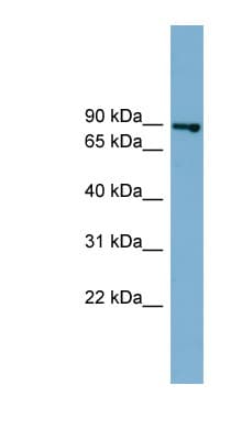 Polyclonal Rabbit anti-Human FASTKD2 Antibody (aa611-660, WB)