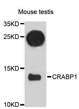 CRABP1 / CRABP Antibody