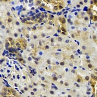 B9D1 Antibody