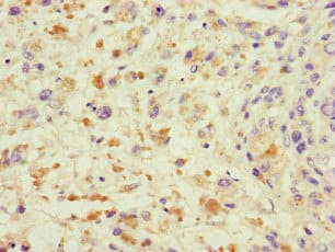 Polyclonal Rabbit anti-Human TRAF2 Antibody (IHC, IF)