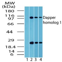 IHC-plus™ DACT1 / DAPPER Antibody (aa725-775)