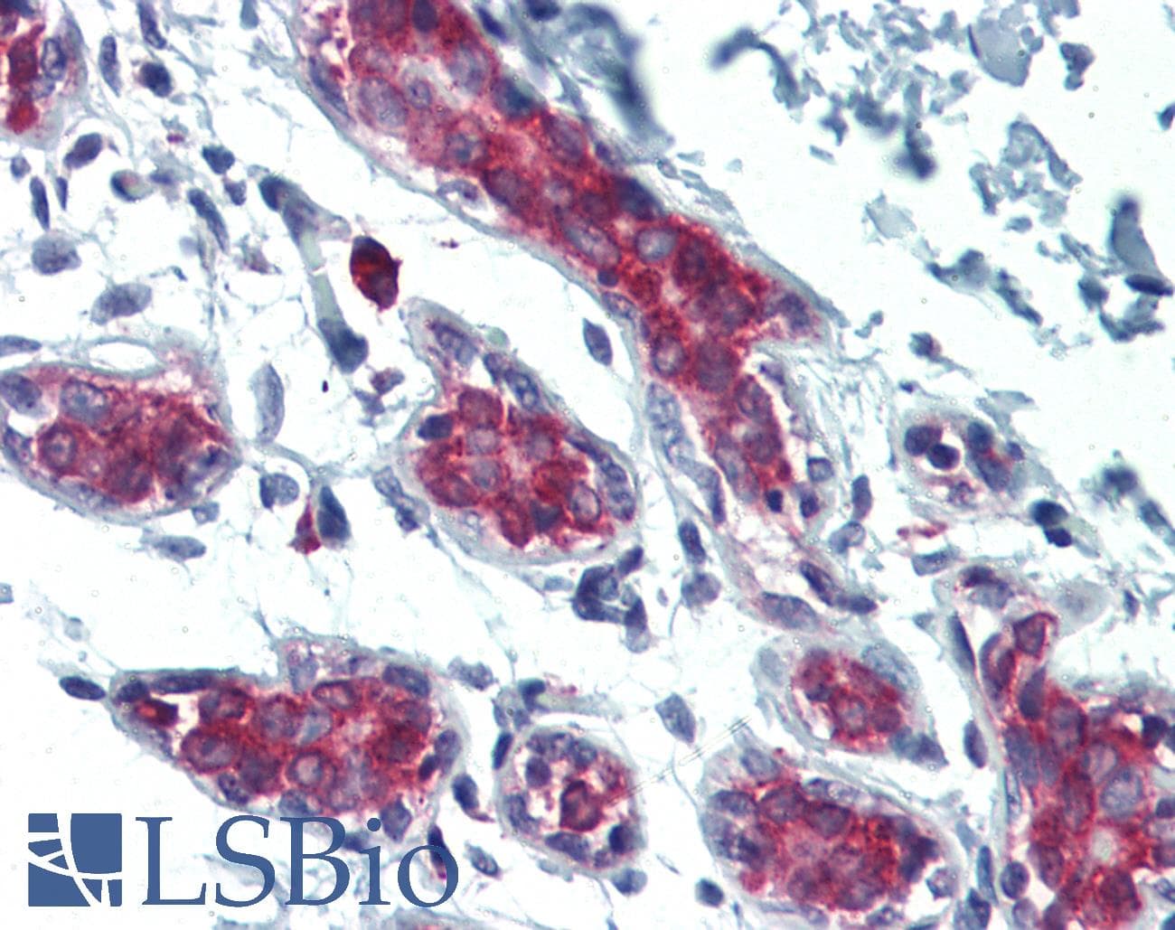 IHC-plus™ Polyclonal Rabbit anti-Human FHIT Antibody (IHC, WB)