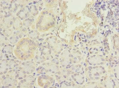 PFDN2 Antibody