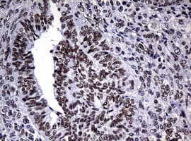 NBN / Nibrin Antibody (clone OTI2E10)