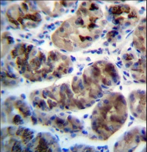 Polyclonal Rabbit anti-Human ZDHHC20 Antibody (aa26-54, IHC, WB)