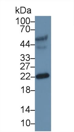 EFNA3 / Ephrin A3 Antibody (aa30-238)