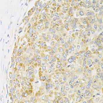 PPP1CA / PP1-Alpha Antibody