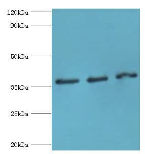 DFFA / ICAD / DFF45 Antibody (aa1-331)