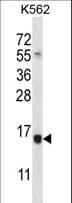 SELK / Selenoprotein K Antibody (aa32-61)