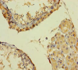 SMARCA2 / BRM Antibody (aa700-1216)