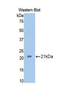 HSPBP1 Antibody (aa198-352, PE)