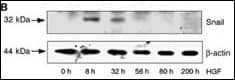 Polyclonal Rabbit anti-Human SNAI1 / SNAIL-1 Antibody (aa9-39, IHC, WB)