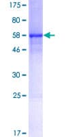 Human C1QTNF9 Protein (Recombinant GST)