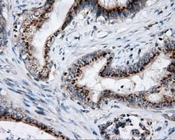 LIPG / Endothelial Lipase Antibody (clone OTI2H10)
