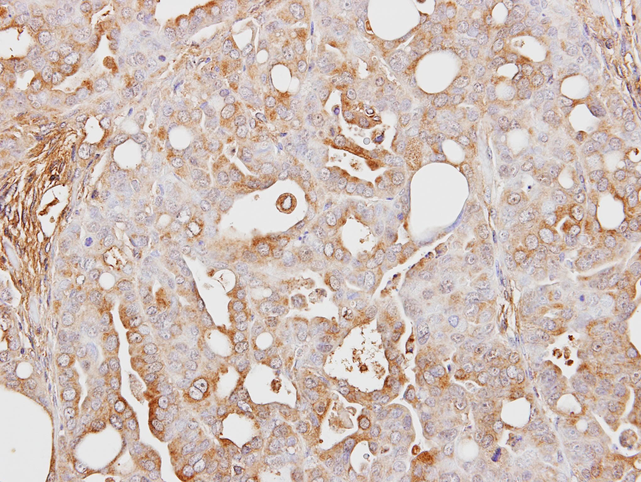 ITIH3 Antibody (aa119-383)