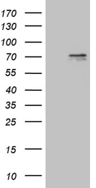 Monoclonal Mouse anti-Human PRMT5 Antibody (clone OTI1F8, aa238-499, WB)