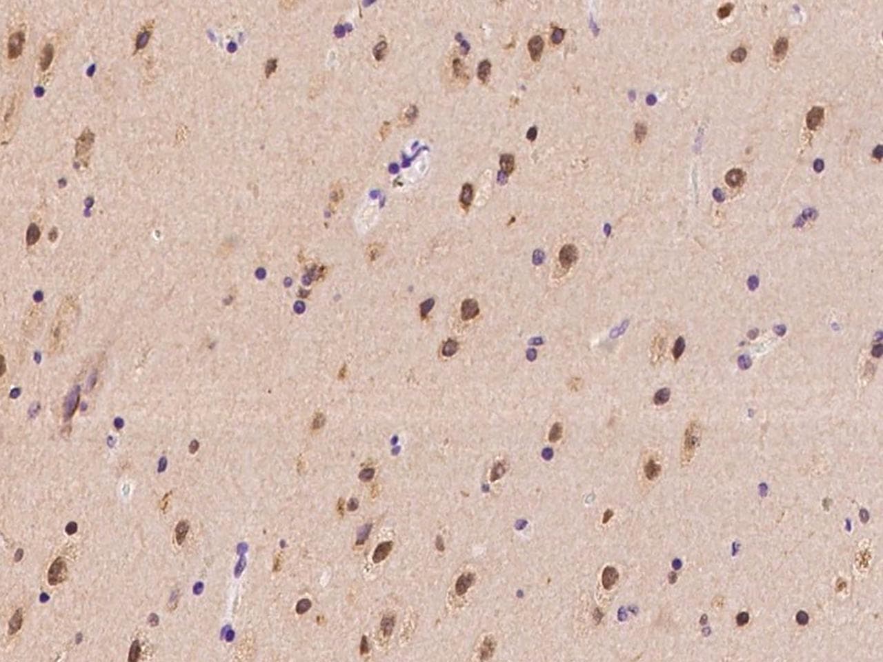 Polyclonal Rabbit anti-Human SLC29A2 / ENT2 Antibody (IHC)