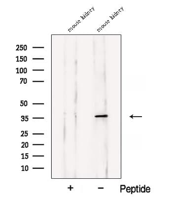ASPA Antibody