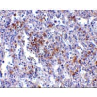 Polyclonal Rabbit anti-Human TMC6 Antibody (IHC, IF, WB)