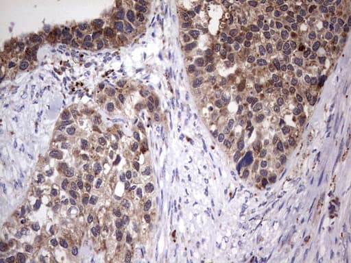 Monoclonal Mouse anti-Human PPP2R5D Antibody (clone OTI5E7, IHC, WB)