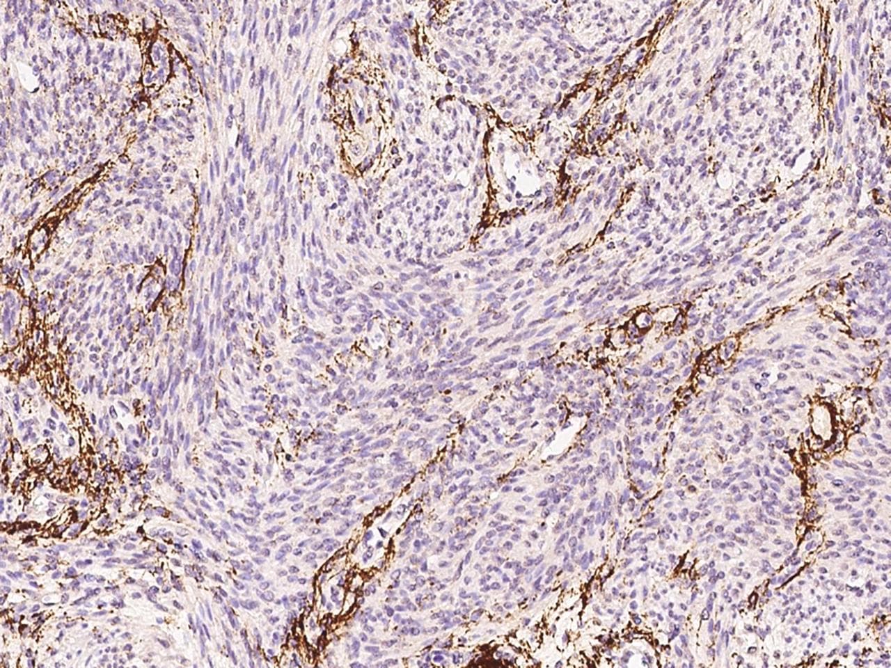 ELN / Elastin Antibody