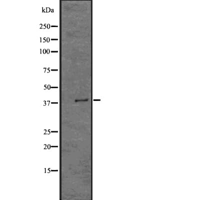 HLA-A Antibody