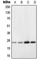 NDUFV2 Antibody (Internal)