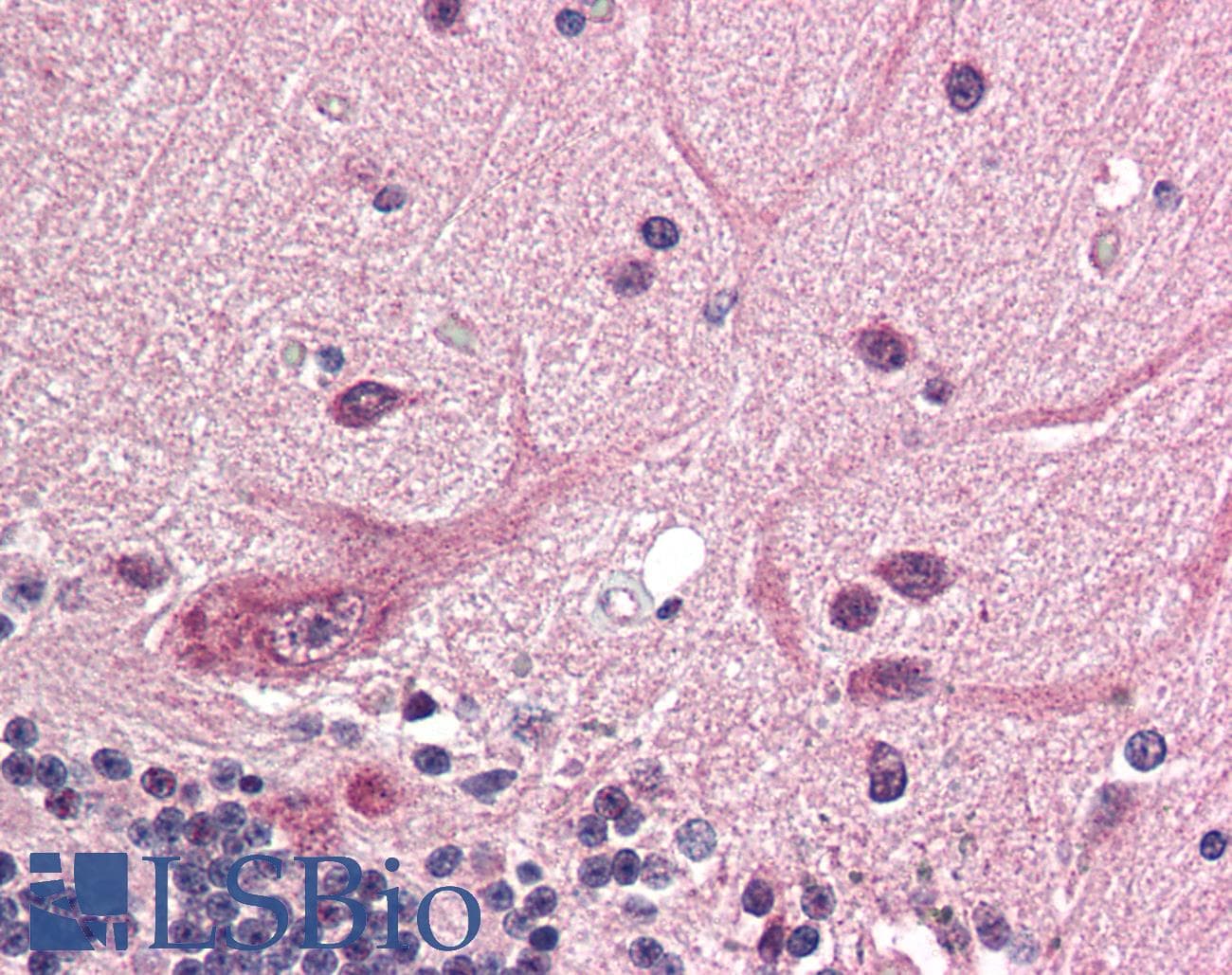 IHC-plus™ Polyclonal Rabbit anti-Human RNF25 Antibody (IHC, WB)
