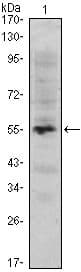 MUM1 Antibody (clone 4G10)