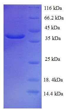 Human Mucin 2 / MUC2 Protein (Recombinant His-SUMO)